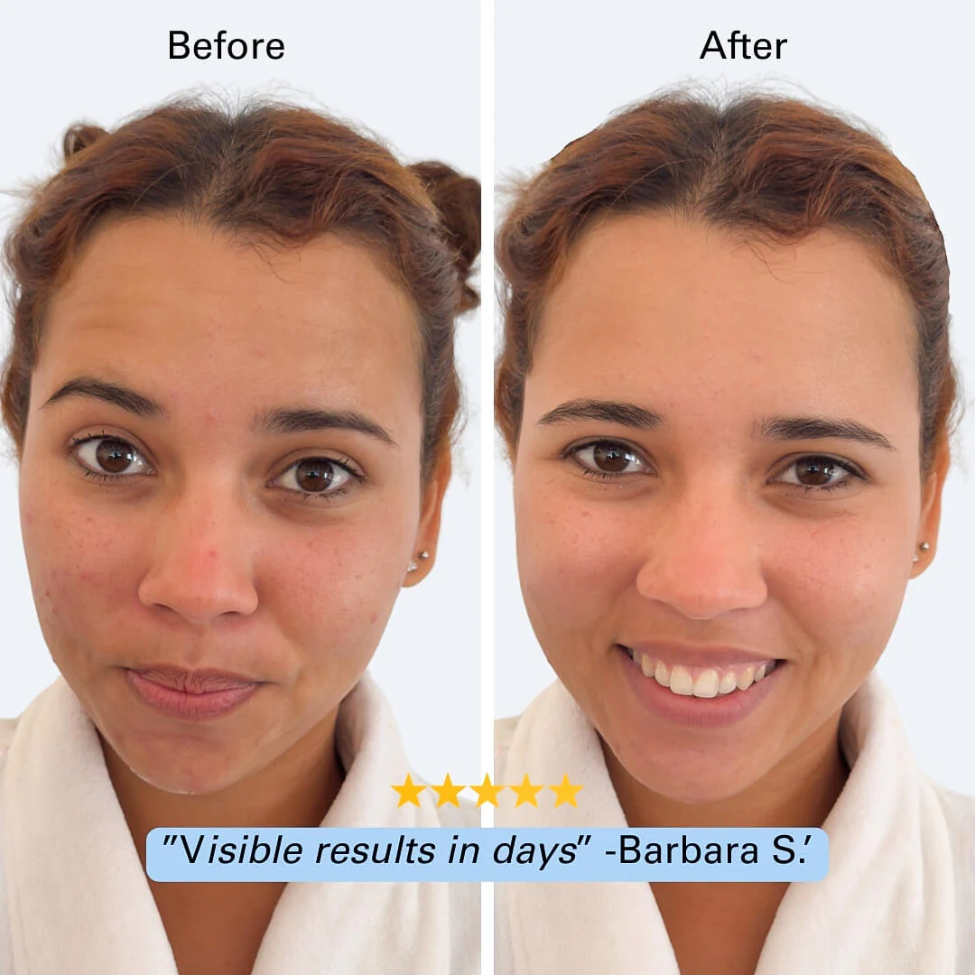 Face Cleaner Pro™ - Image 3