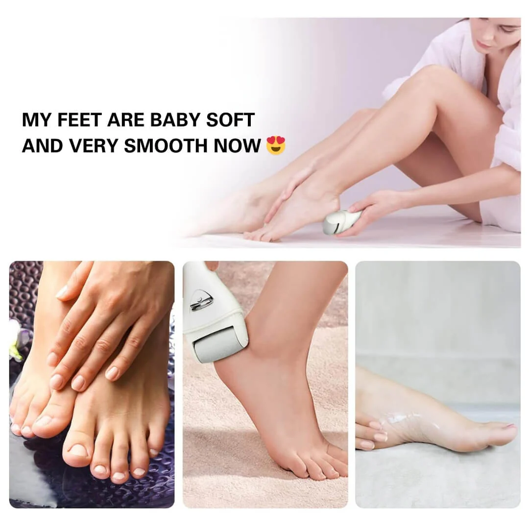 Blissal Rechargeable Foot Callus Remover - Image 8